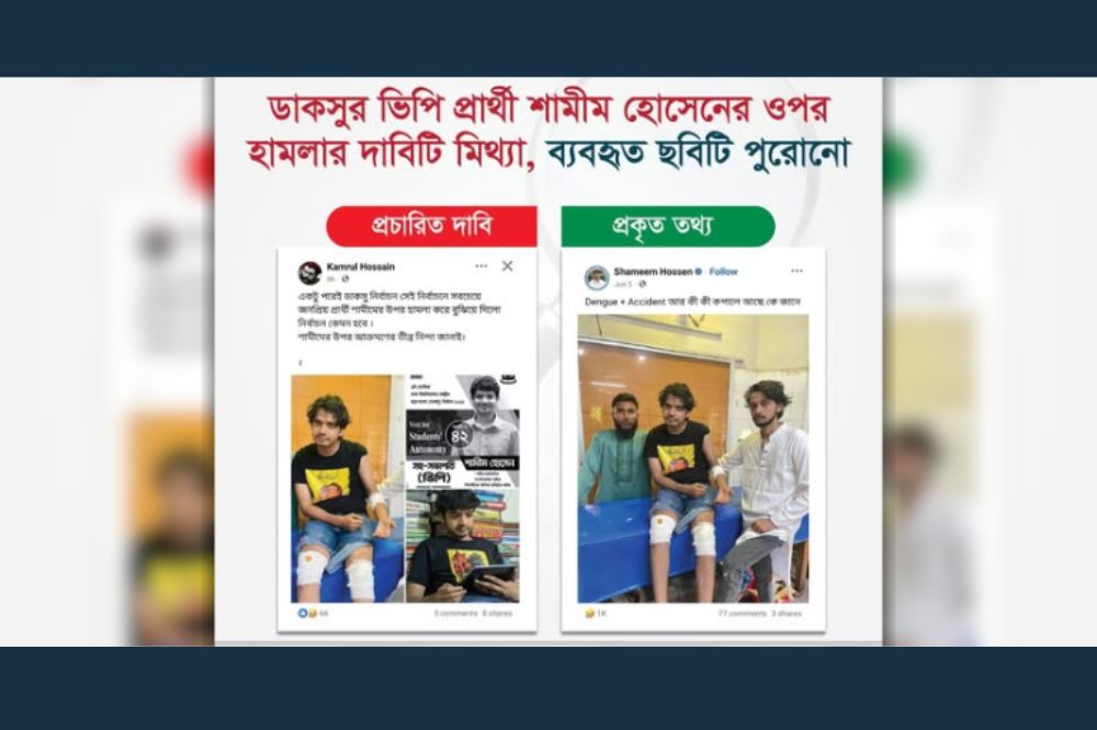 ডাকসুর ভিপি প্রার্থী শামীম হোসেনের ওপর হামলার দাবিটি মিথ্যা, ব্যবহৃত ছবিটি পুরোনো